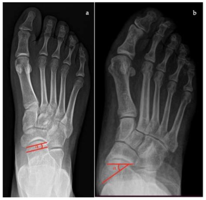 Damian Priest's Height In Feet: Uncovering The Mystery