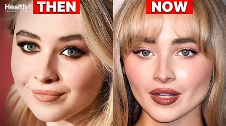 Did Sabrina Carpenter Ever Get Cosmetic Surgery? A Closer Look