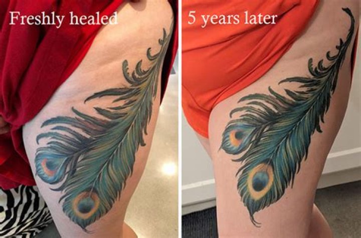 Discover The Truth: Tattoos Before Surgery