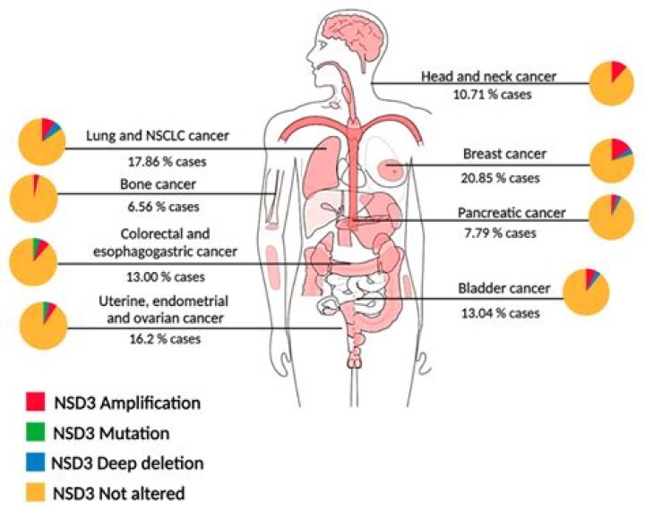 "Does RDJ Have Cancer?" Unraveling Facts And Misconceptions