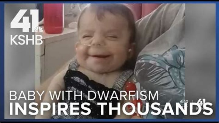 Exploring Dwarfism And The Journey Of A Special Baby