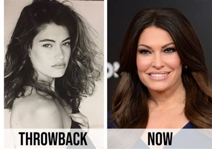 Has Kimberly Guilfoyle's Plastic Surgery Transformed Her Appearance?