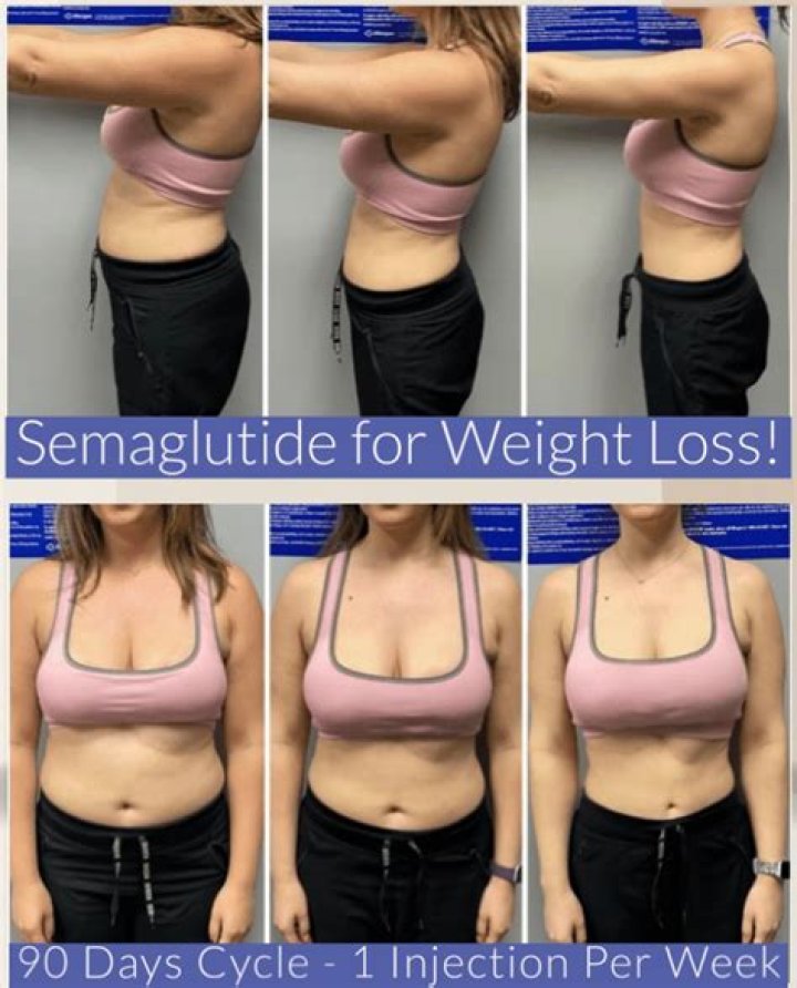 Jacksonville Semaglutide Weight Loss Clinic in Florida