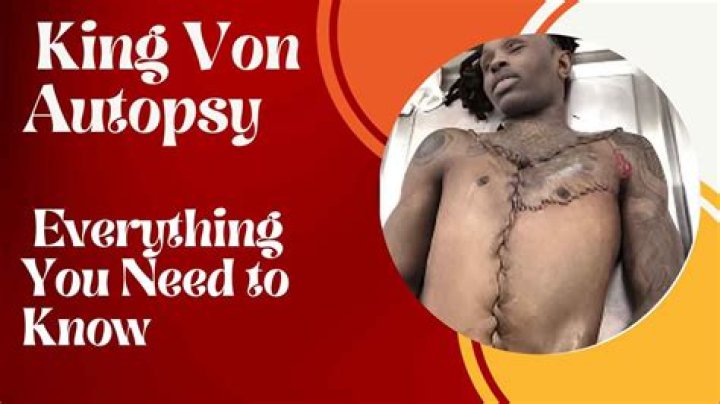 King Von Autopsy Reveals Startling Discoveries