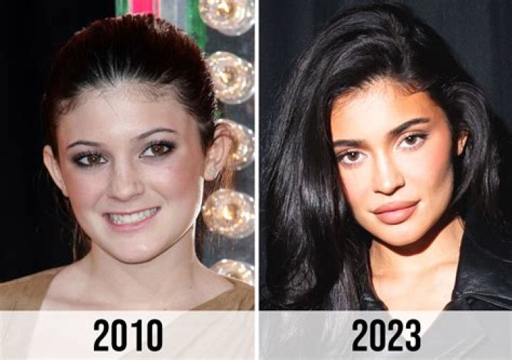 Kylie Jenner's Before And After Transformation: Unveiling The Secrets