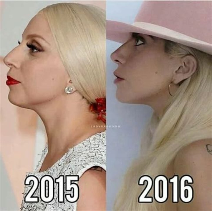 Lady Gagas Transformative Journey: Unveiling The Truth About Her Gender Identity