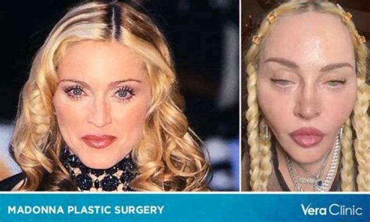 Patricia Heaton's Plastic Surgery: Before And After Photos And Details