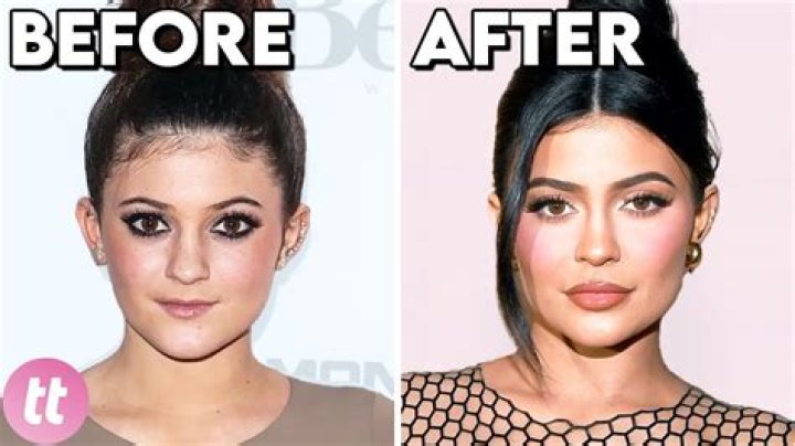Plastic Surgery Before And After Insights