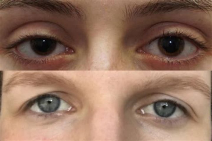Prey Eyes: The Eyes That See In Darkness