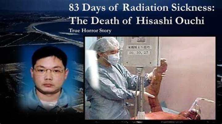 The Real History Of Hisashi Ouchi: A Tragic Tale Of Radiation Exposure
