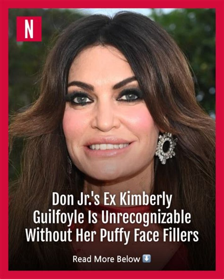 The Truth About Kimberly Guilfoyle's Fillers Revealed