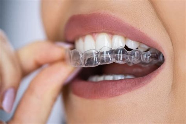 The Ultimate Guide To Bracefacelaii Number: What It Is And How To Use It