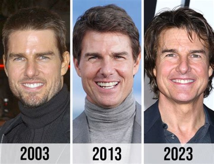 Tom Cruise's Nose Job Transformation Revealed