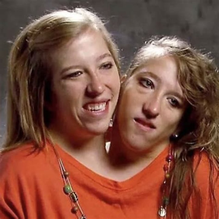 Tragic Loss: The Death Of Conjoined Twins Abby And Brittany Hensel