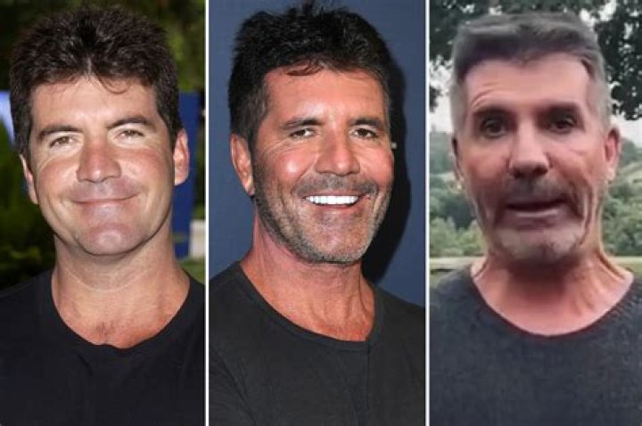 Uncovering New Horizons In Simon Cowell's Cancer Journey: Discoveries And Insights