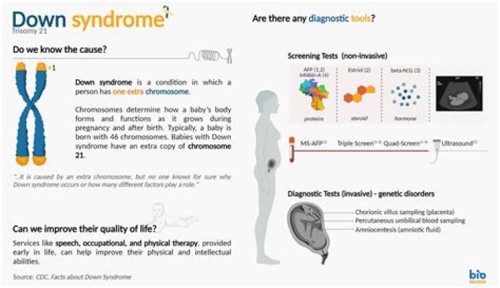 Uncovering The Facts About Down Syndrome