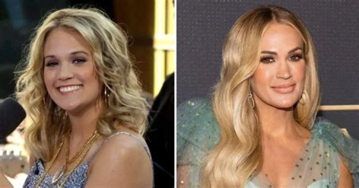 Unveiling Carrie Underwood's Lip Filler Journey: Before And After
