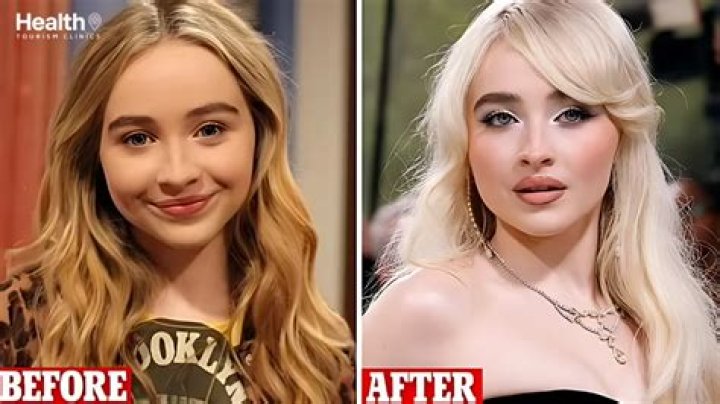 What You Need To Know About Sabrina Carpenter's Plastic Surgery Rumors